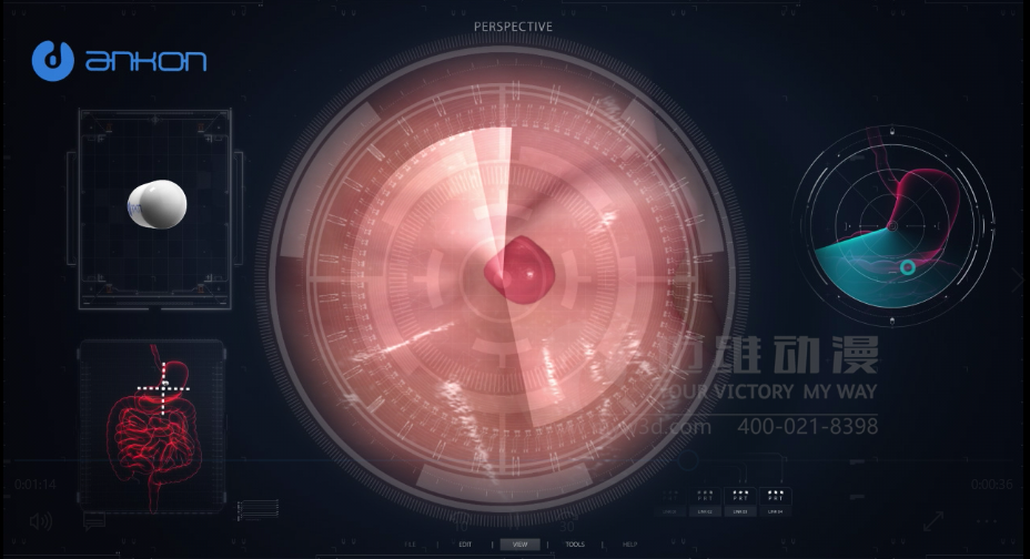 医学医疗三维动画 医学医疗三维动画